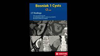 Bosniak 1 Cyst  CT  Radiology [upl. by Emmerich814]