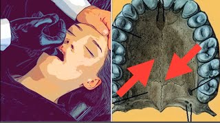 Pulse Oral Craniofacial Gut amp Groin Chiropractic in Anime [upl. by Batista]