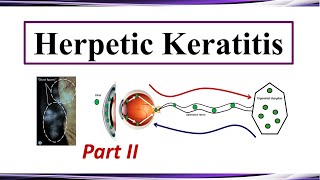 Herpetic Keratitis  Therapy Part II [upl. by Cila653]