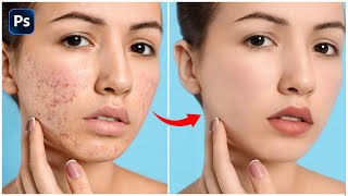 Skin Retouching 2024  HighEnd Face Retouching  Best Photoshop Tutorial [upl. by Gnut]