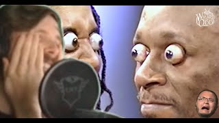 Forsen Reacts  Eye Popper Challenge  World Record For Eyes Popping Out The Furthest [upl. by Bandur]