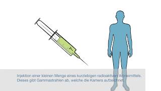 Nuklearmedizinische Untersuchung  Institut für Radiologie und Nuklearmedizin – Stadtspital Triemli [upl. by Perla974]