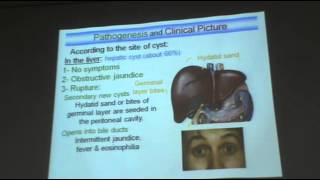 DrAzza   Parasitology quotEchinococcus granulosus amp hydatidosisquot [upl. by Airitac]