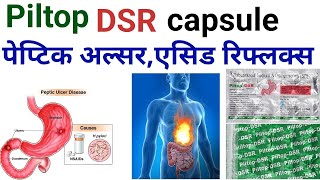 Piltop dsr capsule uses benifits precaution in hindihow to take and work piltop dsr capsuledsr cap [upl. by Lantz]