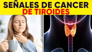 ASI EMPIEZA el Cáncer de Tiroides y nadie te lo dice signos y síntomas de cáncer de tiroides [upl. by Lidstone]