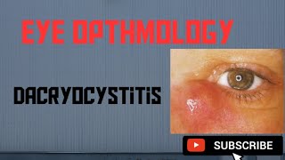 Dacryocystitis  Causes Symptoms Treatment [upl. by Iznek]