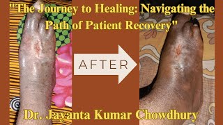 1 Patient Recovery by Dr Jayanta Kumar Chowdhury  Electro Homeopathy [upl. by Dixil]