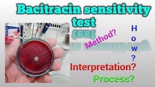 Bacitracin Sensitivity Test Microbiology [upl. by Conn]