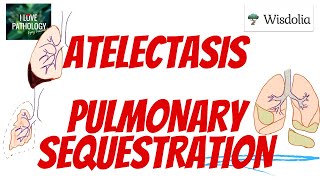 ATELECTASIS  PULMONARY SEQUESTRATION Morphology Types  prognosis [upl. by Ultan]