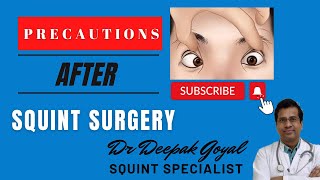 Precautions After Squint Surgery Dr Deepak Goyal  Pediatric Ophthamologist [upl. by Najar]