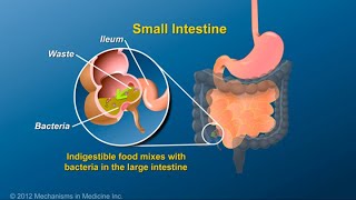 Livia Biancone Screening per le neoplasie nelle Malattie Infiammatorie Croniche Intestinali MICI [upl. by Palua]