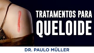 Tratamentos para Queloide – Dr Paulo Müller Dermatologista [upl. by Haerb613]