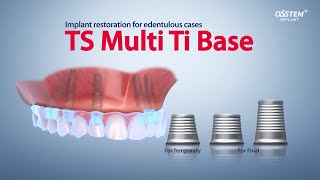 TS Multi Ti Base Ti Base for digital denture solution [upl. by Dreeda]