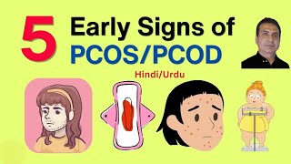 PCOS Symptoms amp Treatment Options pcos PolcysticOvarianSyndrome drabbasofficial [upl. by Theurich]