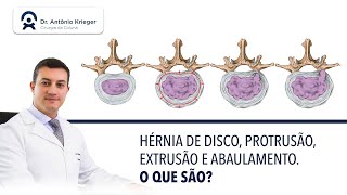 Hérnia de disco protusão extrusão e abaulamento discal O que são [upl. by Brucie569]