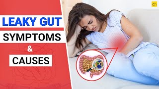 What is Leaky Gut Symptoms and Causes guthealth  Credihealth [upl. by Ollie]