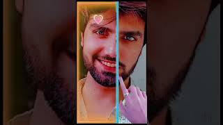 New smile effect capcut  Link tiktok pr ha❤️ doctor shorts viral bibishirini capcut template [upl. by Miriam689]