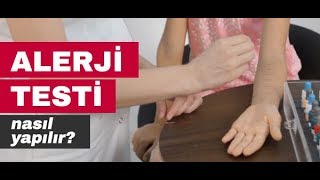 Alerji Testi Nasıl Yapılır  İstanbul Alerji [upl. by Cerelly916]