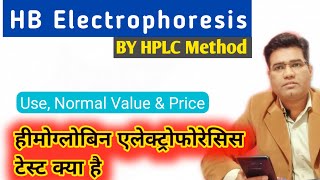 HB Electrophoresis Test by HPLC Method  Use Procedure Result Interpretation [upl. by Cyd743]