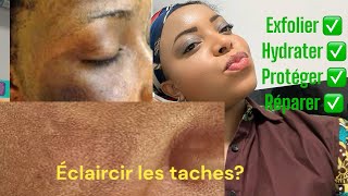 Comment s’en débarrasser rapidement de l’hyperpigmention✅taches✅acnés ✅ malsma✅conseille ampproduits [upl. by Anitnauq]