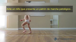 ¿Qué hacemos ante un niño que presenta un patrón de marcha patológico [upl. by Grannias]