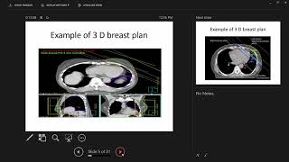 Cardiotoxicity in Cancer Patients Dr Ahmed Hassan Abdelaziz [upl. by Ylurt359]