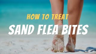 Immediate Action How to Treat Sand Flea Bites Like a Pro [upl. by Lynd]