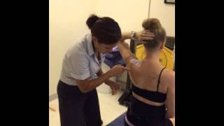 Upward rotation scapular taping [upl. by Yesnikcm403]