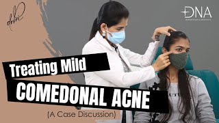 How to treat mild comedonal acne tips from a dermatologist  Dr Priyanka reddy [upl. by Milore412]