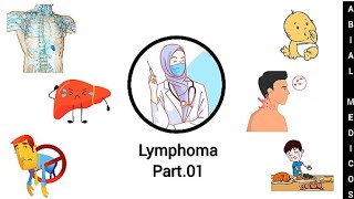 Lymphoma  Hodgkins lymphoma  Sign and symptoms  Diagnosis  Treatment [upl. by Cantone]