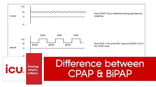 Difference between CPAP and BiPAP  NIV vs CPAP [upl. by Ardolino573]