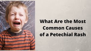 What Are the Most Common Causes of a Petechial Rash [upl. by Otreblanauj]