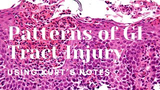 Patterns of GI Tract Injury Kurt’s Notes pathagonia [upl. by Onit704]