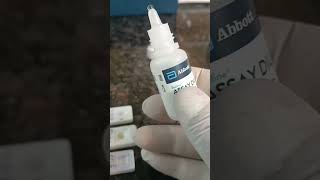 HIV HCV HBSAG Test Procedure by Kit laboratory pathology medicallaboratory lab labtechdt [upl. by Idoc]