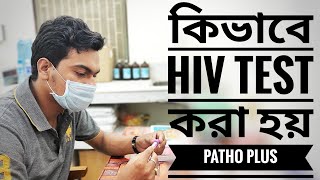 HIV test  কিভাবে HIV test করা হয় HIV kit test  Total procedure [upl. by Leffen]