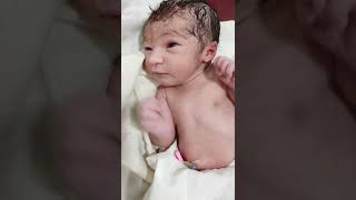 Lip quivering of newborn baby just after birth is cutest thing ever shorts [upl. by Ssor]