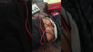 Tens therapy for back pain 🔥 back pain treatment physiotherapy chiropratic trending shorts [upl. by Egiaf85]