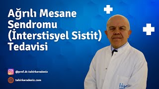 Ağrılı Mesane Sendromu İnterstisyel Sistit Tedavisi [upl. by Hayley]