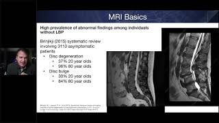 ASPN Lumbar MRI Understanding the Basics to Facilitate Interpretation [upl. by Willard797]