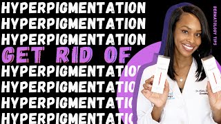 How to get rid of Hyperpigmentation Dark Spots and Melasma [upl. by Iramat38]