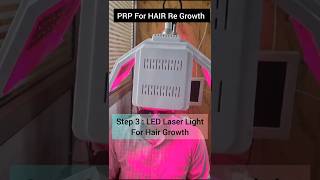 Hair regrowth treatment GFCHAIR hair haircare hairtransformation gfctherapy gfc laser [upl. by Siram481]