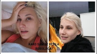 KAKO SAM SE REŠILA BUBULJICA [upl. by Anitnelav]