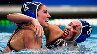 The Top 5 Most Devastating Water Polo Injuries of All Time [upl. by Retepnhoj]