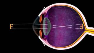 The Eye and Focus  3D Medical Animation  ABP © [upl. by Haleeuqa]