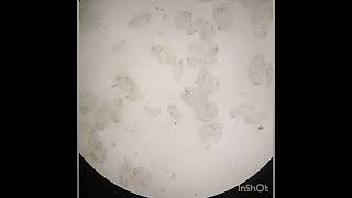 Paramecium and its conjugation process under microscope TheNatureandScience [upl. by Giuliana]