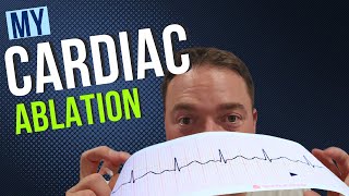 My Cardiac Ablation [upl. by Gudrun]