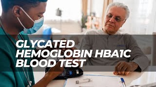 Glycated Hemoglobin HbA1c Blood Test in Diabetic Patients  A1c Level Diabetes Mellitus Type 2 [upl. by Direj]