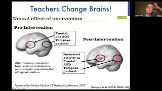 Why Bring the Science of Reading amp Structured Literacy into the Classroom A Talk w Margie Gillis [upl. by Lonne]