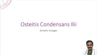 Osteitis Condensans Ilii  DrKathir Azhagan orthomechanic [upl. by Idnar288]