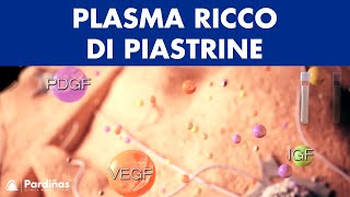 Plasma ricco di piastrine © [upl. by Innor]